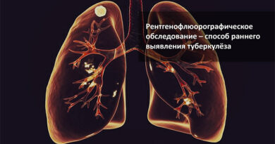 туберкулёз лёгких
